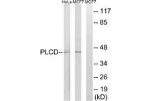 Western blot analysis of extracts from HeLa/MCF-7 cells, using AGPAT4 Antibody.