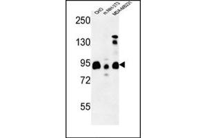 Western blot analysis using SGIP1 Antibody (N-term) Cat. (SGIP1 Antikörper  (N-Term))