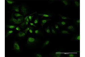 Immunofluorescence of purified MaxPab antibody to BAG1 on HeLa cell.