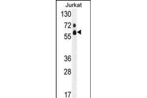 Western blot analysis of hFASTK- (ABIN391120 and ABIN2841247) in Jurkat cell line lysates (35 μg/lane). (FASTK Antikörper  (C-Term))