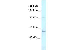 WB Suggested Anti-Aff3 Antibody Titration: 1. (AFF3 Antikörper  (C-Term))