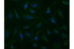 Image no. 3 for anti-Aldehyde Dehydrogenase 1 Family, Member L1 (ALDH1L1) antibody (ABIN1496581) (ALDH1L1 Antikörper)