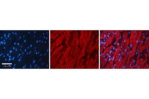 Rabbit Anti-AKR1C3 Antibody Catalog Number: ARP61430_P050 Formalin Fixed Paraffin Embedded Tissue: Human heart Tissue Observed Staining: Cytoplasmic Primary Antibody Concentration: 1:100 Other Working Concentrations: N/A Secondary Antibody: Donkey anti-Rabbit-Cy3 Secondary Antibody Concentration: 1:200 Magnification: 20X Exposure Time: 0.