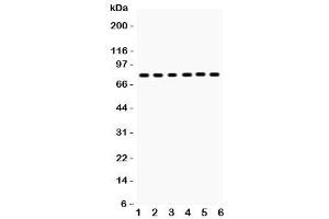 Western blot testing of tPA antibody and Lane 1:  mouse lung (PLAT Antikörper  (AA 366-562))