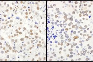 Immunohistochemistry (IHC) image for anti-Protein Quaking (QKI) (C-Term), (Isoform 5) antibody (ABIN7454593) (QKI Antikörper  (C-Term, Isoform 5))