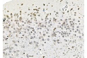 ABIN6263687 and ABIN6279632 at 1/100 staining Rat brain tissue by IHC-P. (NOL7 Antikörper  (C-Term))