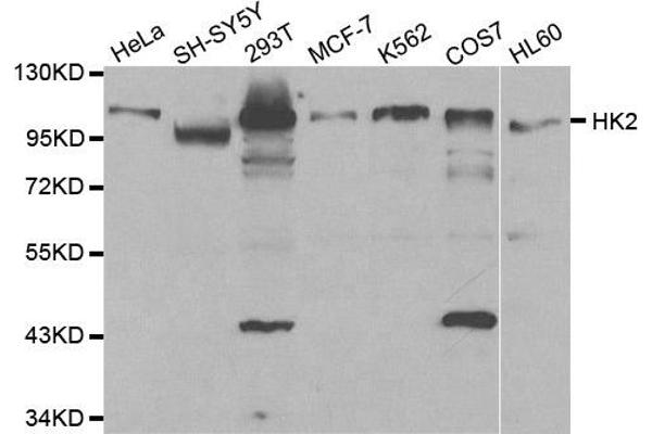 Hexokinase 2 anticorps  (AA 1-120)