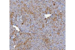 IHC analysis of SHQ1 using anti-SHQ1 antibody (ABIN7599205). (SHQ1 Antikörper  (AA 1-277))