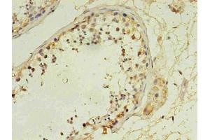 Immunohistochemistry (IHC) image for anti-CD14 (CD14) antibody (ABIN7140933)