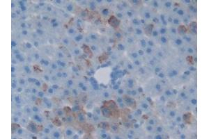 Immunohistochemistry (IHC) image for anti-HSPA Binding Protein, Cytoplasmic Cochaperone 1 (HSPBP1) (AA 198-352) antibody (ABIN7437581)