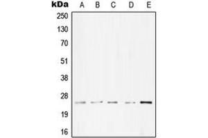 Western blot analysis of cTnI expression in A431 (A), Molt4 (B), A549 (C), NIH3T3 (D), PC12 (E) whole cell lysates. (TNNI3 Antikörper  (Center))