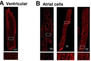 Localization of L-type CaV channels in rat atrial and ventricular cardiomyocytes.