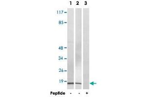 Western blot analysis of extracts from COLO 205 cells (Lane 1 and lane 3) and HeLa cells (Lane 2), using BRP44L polyclonal antibody . (BRP44L Antikörper  (Internal Region))