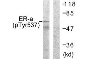 Western blot analysis of extracts from 293 cells, using Estrogen Receptor-alpha (Phospho-Tyr537) Antibody. (Estrogen Receptor alpha Antikörper  (pTyr537))