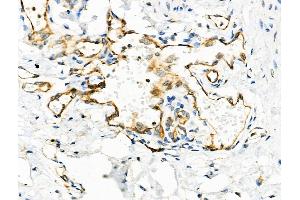 anti-Ribonuclease, RNase A Family, 12 (Non-Active) (RNASE12) (Internal Region) antibody