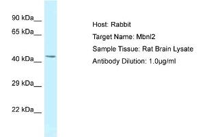 Host: Rabbit Target Name: MBNL2 Sample Tissue: Rat Brain Antibody Dilution: 1ug/ml (MBNL2 Antikörper  (Middle Region))