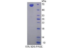 Image no. 1 for Syncoilin (Sync) (AA 169-458) protein (His tag,GST tag) (ABIN4990483)