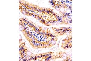 (ABIN6242231 and ABIN6578095) staining (Mouse) Epcam in mouse colon sections by Immunohistochemistry (IHC-P - paraformaldehyde-fixed, paraffin-embedded sections). (EpCAM Antikörper  (C-Term))