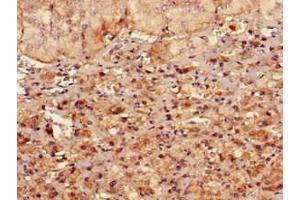 Immunohistochemistry of paraffin-embedded human adrenal gland tissue using ABIN7167713 at dilution of 1:100 (RMND1 Antikörper  (AA 35-160))