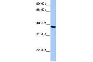 WB Suggested Anti-NAT6 Antibody Titration:  0. (NAT6 Antikörper  (C-Term))