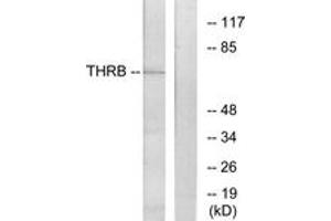 Western blot analysis of extracts from NIH-3T3 cells, using THRB Antibody. (THRB Antikörper  (AA 391-440))