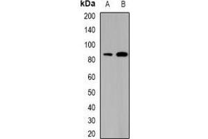 Western blot analysis of SATB1 expression in THP1 (A), mouse thymus (B) whole cell lysates.