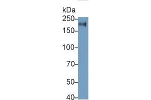 Detection of CD45 in Jurkat cell lysate using Monoclonal Antibody to Protein Tyrosine Phosphatase Receptor Type C (CD45) (CD45 Antikörper  (AA 193-575))