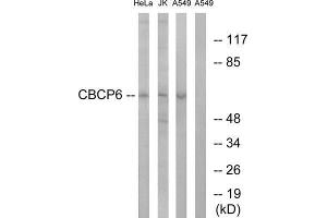 Western Blotting (WB) image for anti-ATP/GTP Binding Protein-Like 4 (AGBL4) (C-Term) antibody (ABIN1851213) (AGBL4 Antikörper  (C-Term))
