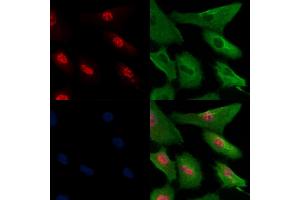 Phospho-CtIP (Thr847) Antibody staining A549 cells(H2O2 treatment) by IF/ICC. (Retinoblastoma Binding Protein 8 Antikörper  (pThr847))