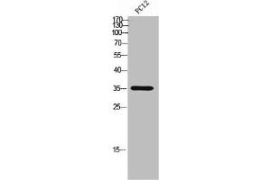 Western Blotting (WB) image for anti-ATPase, Na+/K+ Transporting, beta 3 Polypeptide (ATP1B3) (C-Term) antibody (ABIN7184692)