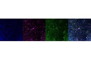 Immunohistochemistry (IHC) image for anti-Ionized Calcium-binding Adapter Molecule 1 (IBA1) antibody (ABIN7456154) (Iba1 Antikörper)