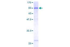 Image no. 1 for DIX Domain Containing 1 (DIXDC1) (AA 1-472) protein (GST tag) (ABIN1351639) (DIXDC1 Protein (AA 1-472) (GST tag))