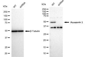 Western blotting analysis using Aquaporin 1 antibody (ABIN7797637). (Rekombinanter Aquaporin 1 Antikörper)