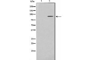 Western blot analysis on HeLa cell lysate using ES8L2 Antibody,The lane on the left is treated with the antigen-specific peptide. (EPS8-Like 2 Antikörper  (N-Term))