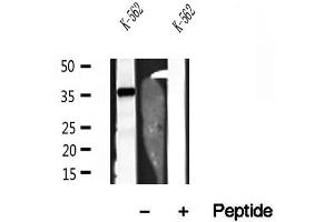 Western blot analysis of extracts of K-562 cells, using JTV1 antibody. (AIMP2 Antikörper  (Internal Region))