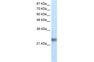 Western Blotting (WB) image for anti-Ring Finger Protein 114 (RNF114) antibody (ABIN2460666) (RNF114 Antikörper)