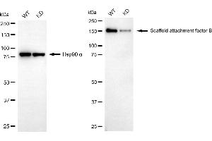 Western blotting analysis using scaffold attachment factor B antibody (ABIN7800275). (Rekombinanter SAFB Antikörper)