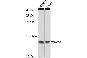 Western blot analysis of extracts of various cell lines, using LSM2 antibody (ABIN6131870, ABIN6143358, ABIN6143359 and ABIN6224004) at 1:1000 dilution. (LSM2 Antikörper  (AA 1-95))