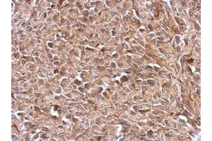 IHC-P Image Immunohistochemical analysis of paraffin-embedded RT2 xenograft, using TrxR1, antibody at 1:500 dilution. (TXNRD1 Antikörper)