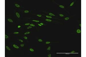 Immunofluorescence of purified MaxPab antibody to HNRNPUL1 on HeLa cell. (HNRNPUL1 Antikörper  (AA 1-804))