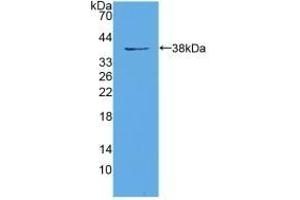 Detection of Recombinant EIF3A, Mouse using Polyclonal Antibody to Eukaryotic Translation Initiation Factor 3A (EIF3A) (EIF6 Antikörper  (AA 622-848))