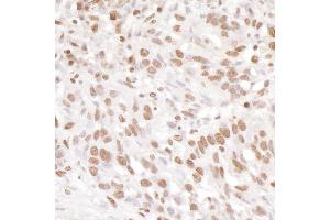 Immunohistochemistry (IHC) image for anti-Ewing Sarcoma Breakpoint Region 1 (EWSR1) (AA 100-150) antibody (ABIN7453905) (EWSR1 Antikörper  (AA 100-150))