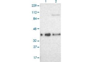 Western blot analysis of Lane 1: Human cell line RT-4 Lane 2: Human cell line U-251MG sp with CDKN1C polyclonal antibody  at 1:100-1:250 dilution. (CDKN1C Antikörper)