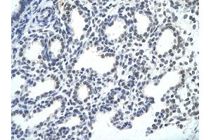 Rabbit Anti-SMNDC1 antibody   Paraffin Embedded Tissue: Human Lung cell Cellular Data: alveolar cell of renal tubule Antibody Concentration: 4. (SMNDC1 Antikörper  (Middle Region))