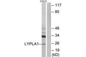 Western blot analysis of extracts from COLO cells, using LYPLA1 Antibody.