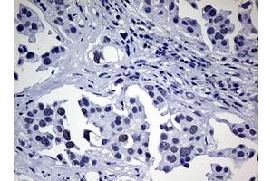 Image no. 1 for anti-Nibrin (NBN) (AA 183-460) antibody (ABIN1491067) (Nibrin Antikörper  (AA 183-460))