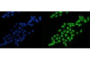 IF analysis of splicing factor 1 using anti-splicing factor 1 antibody (ABIN7600194). (Splicing Factor 1 Antikörper  (AA 160-266))