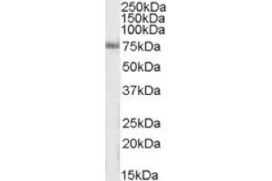 Image no. 1 for anti-Inositol-Trisphosphate 3-Kinase C (ITPKC) (Internal Region) antibody (ABIN375071) (ITPKC Antikörper  (Internal Region))