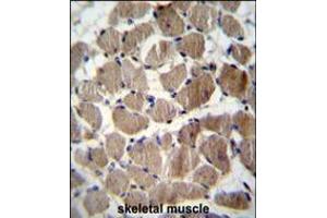 COCH Antibody immunohistochemistry analysis in formalin fixed and paraffin embedded human skeletal muscle followed by peroxidase conjugation of the secondary antibody and DAB staining. (COCH Antikörper  (AA 399-428))
