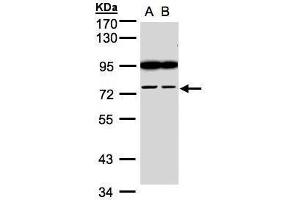 FSD2 Antikörper  (N-Term)